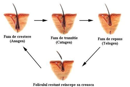 epilarea cu laser magma